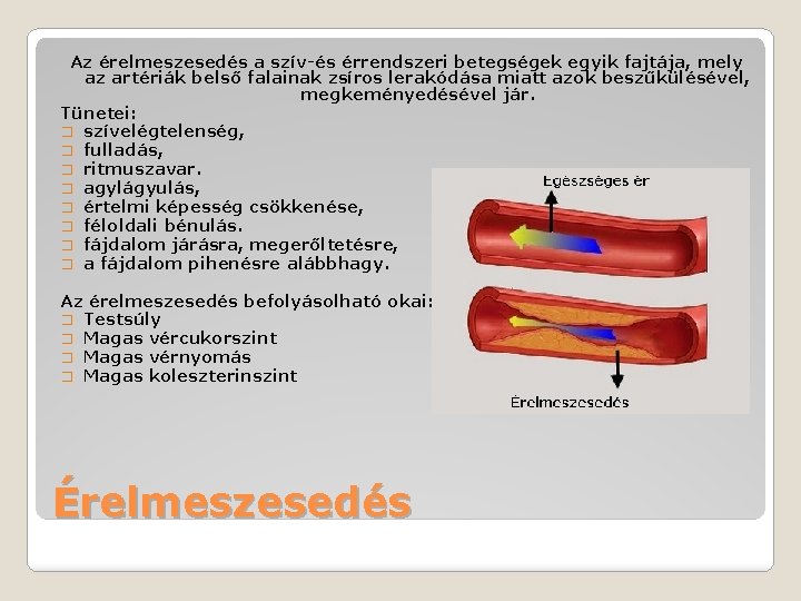 Az érelmeszesedés a szív-és érrendszeri betegségek egyik fajtája, mely az artériák belső falainak zsíros