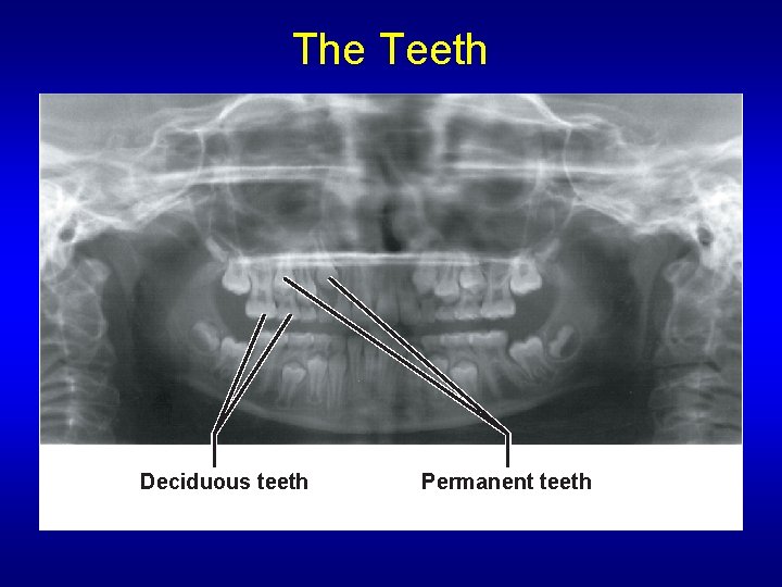 The Teeth Deciduous teeth Permanent teeth 
