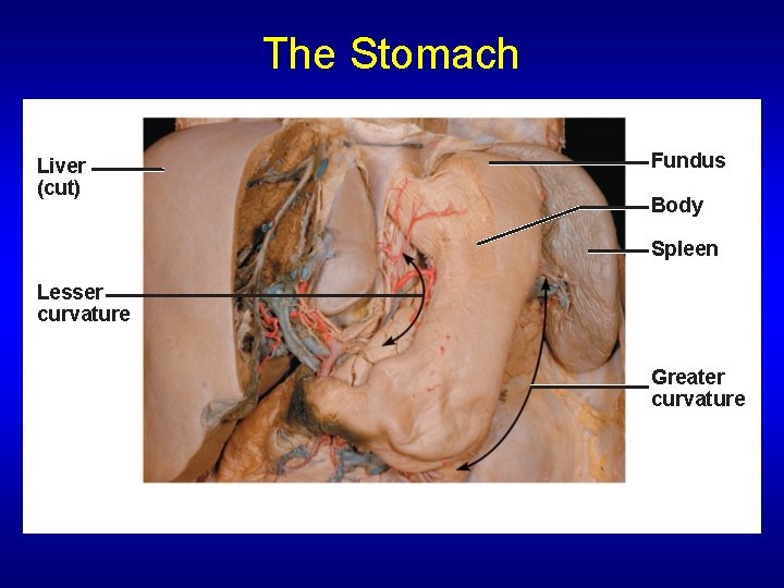 The Stomach Liver (cut) Fundus Body Spleen Lesser curvature Greater curvature 