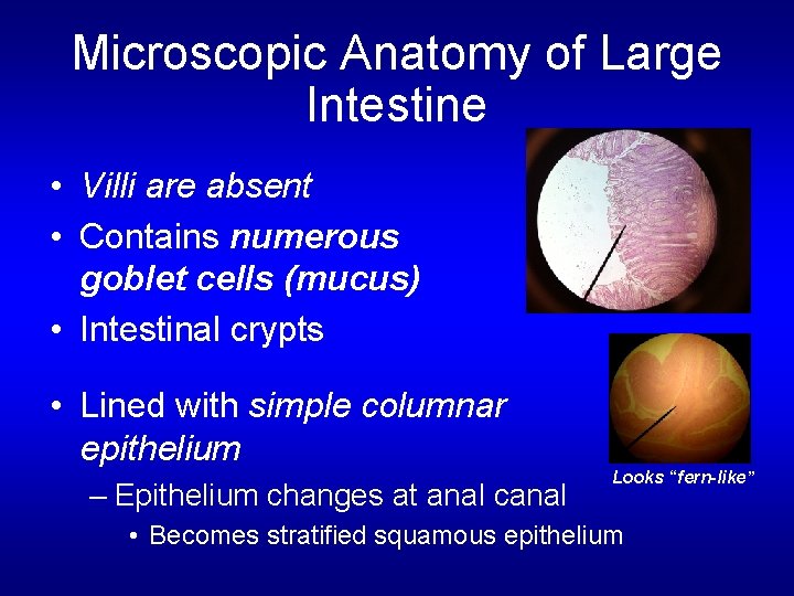 Microscopic Anatomy of Large Intestine • Villi are absent • Contains numerous goblet cells