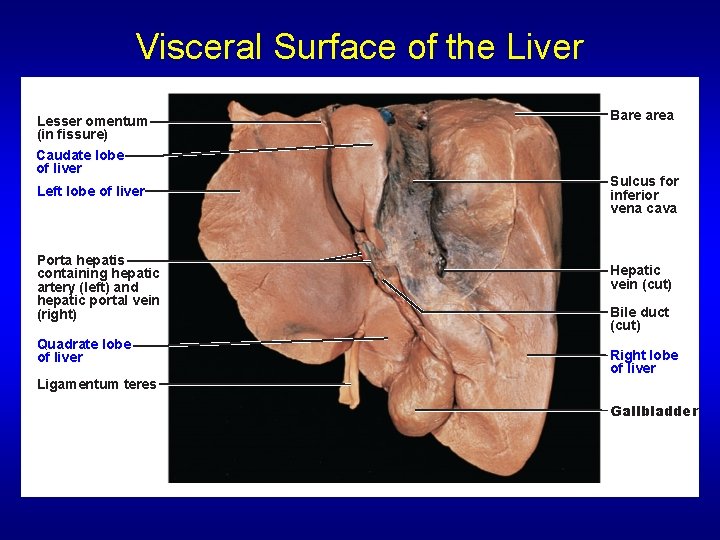 Visceral Surface of the Liver Lesser omentum (in fissure) Caudate lobe of liver Left