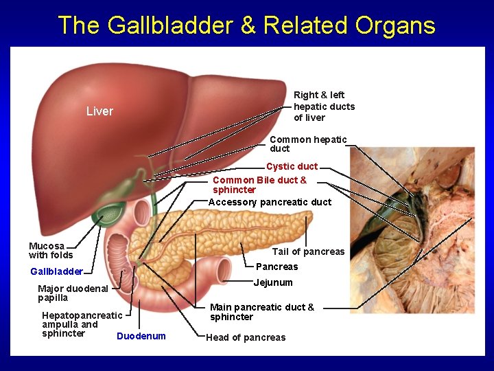 The Gallbladder & Related Organs Right & left hepatic ducts of liver Liver Common