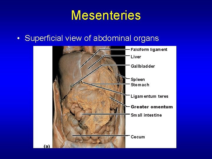 Mesenteries • Superficial view of abdominal organs Falciform ligament Liver Gallbladder Spleen Stomach Ligamentum
