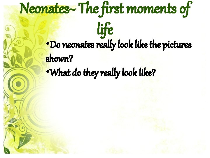 Neonates~ The first moments of life • Do neonates really look like the pictures