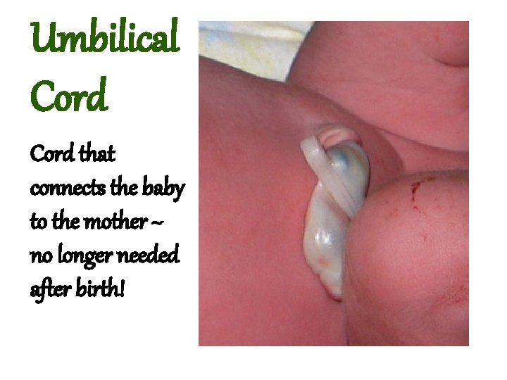 Umbilical Cord that connects the baby to the mother ~ no longer needed after