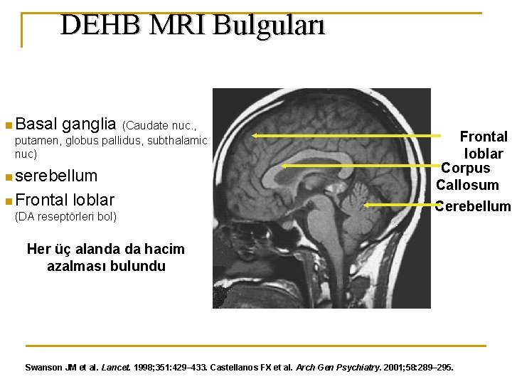 DEHB MRI Bulguları n Basal ganglia (Caudate nuc. , putamen, globus pallidus, subthalamic nuc)