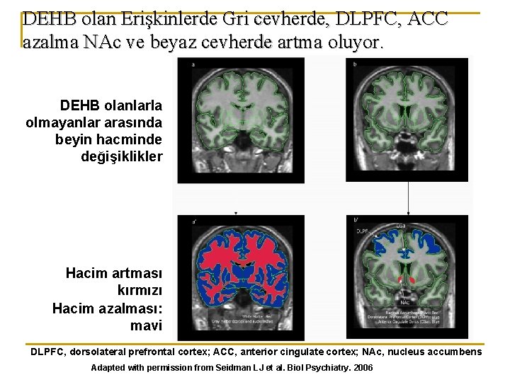 DEHB olan Erişkinlerde Gri cevherde, DLPFC, ACC azalma NAc ve beyaz cevherde artma oluyor.