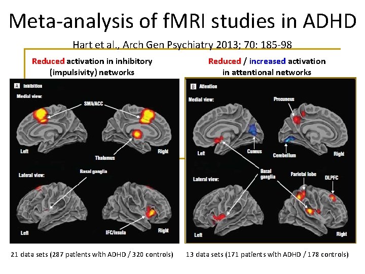 Meta-analysis of f. MRI studies in ADHD Hart et al. , Arch Gen Psychiatry