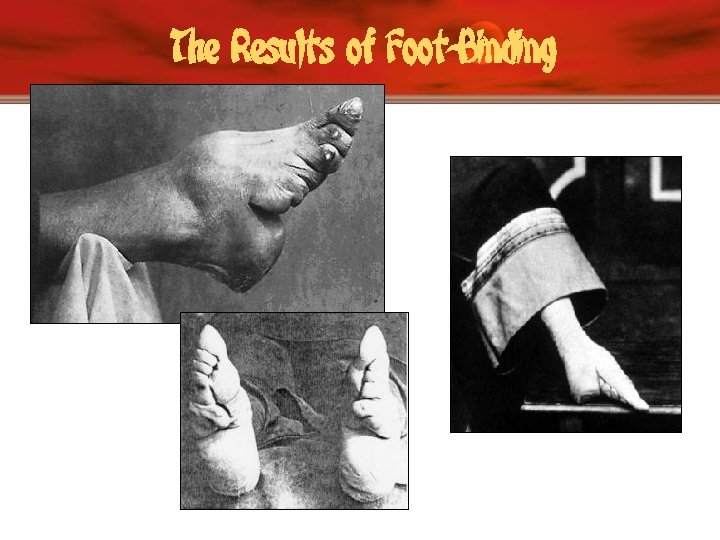 The Results of Foot-Binding 