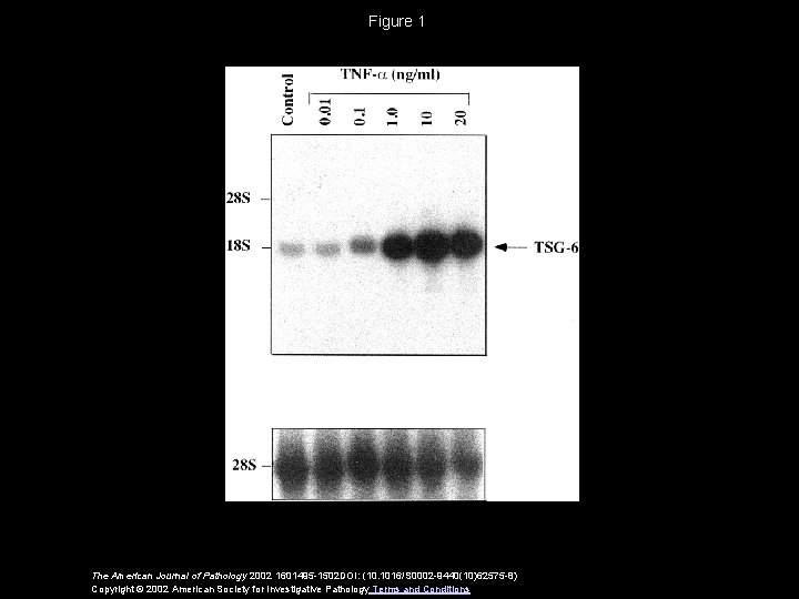 Figure 1 The American Journal of Pathology 2002 1601495 -1502 DOI: (10. 1016/S 0002