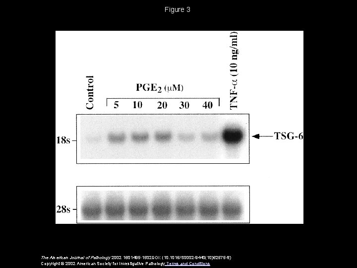 Figure 3 The American Journal of Pathology 2002 1601495 -1502 DOI: (10. 1016/S 0002
