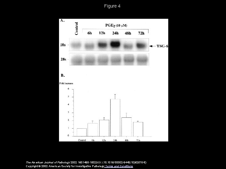 Figure 4 The American Journal of Pathology 2002 1601495 -1502 DOI: (10. 1016/S 0002