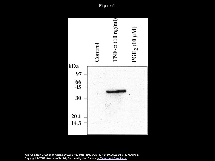 Figure 5 The American Journal of Pathology 2002 1601495 -1502 DOI: (10. 1016/S 0002