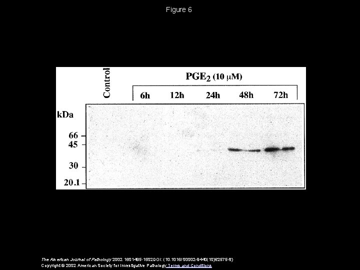 Figure 6 The American Journal of Pathology 2002 1601495 -1502 DOI: (10. 1016/S 0002