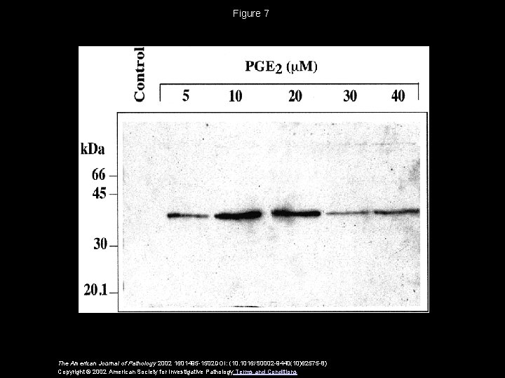 Figure 7 The American Journal of Pathology 2002 1601495 -1502 DOI: (10. 1016/S 0002
