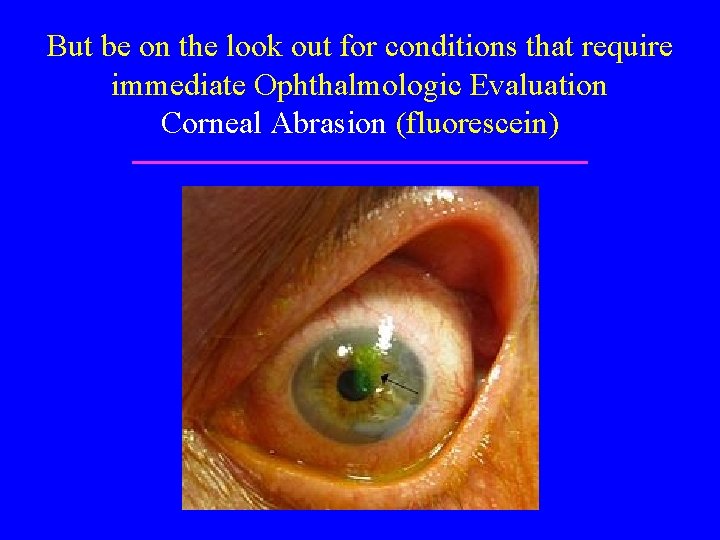 But be on the look out for conditions that require immediate Ophthalmologic Evaluation Corneal