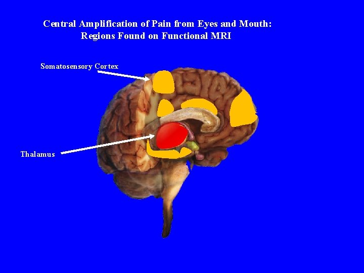 Brain Regions that May Modulate Pain and 1 -4 and Mouth: Central Amplification of.