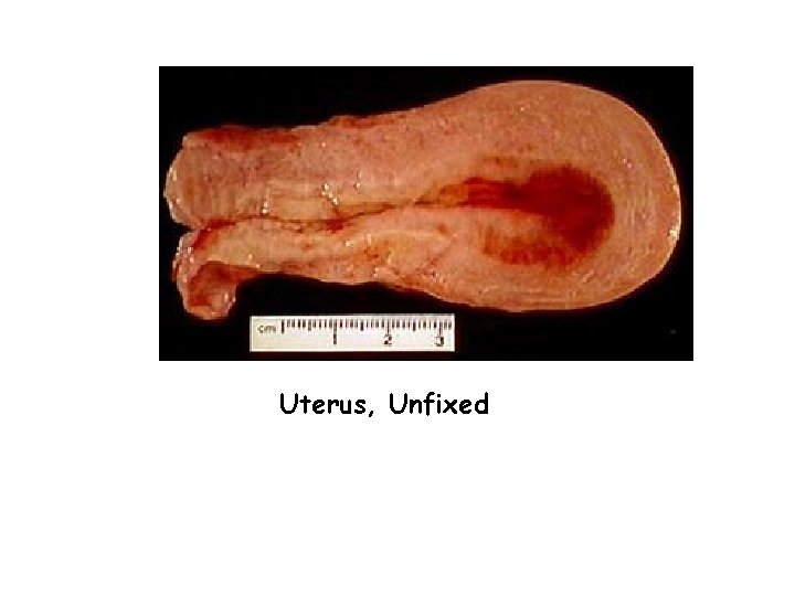 Uterus, Unfixed 