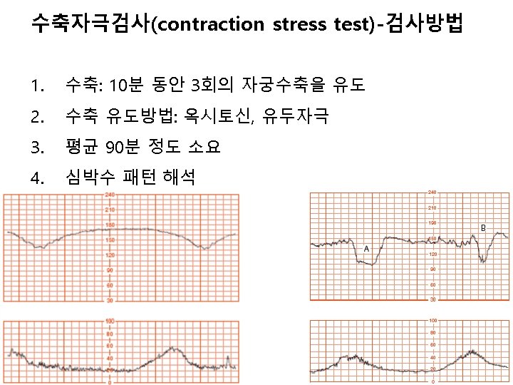 Fetal movements Fetal breathing Contraction stress testing Nonstress