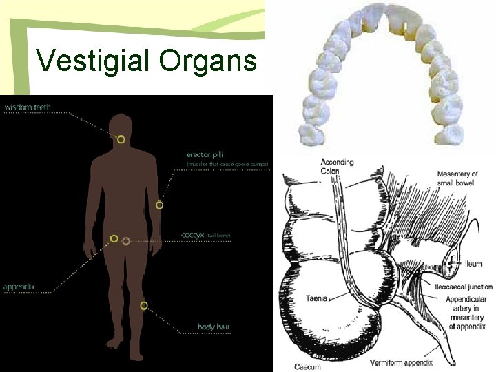 Vestigial Organs 