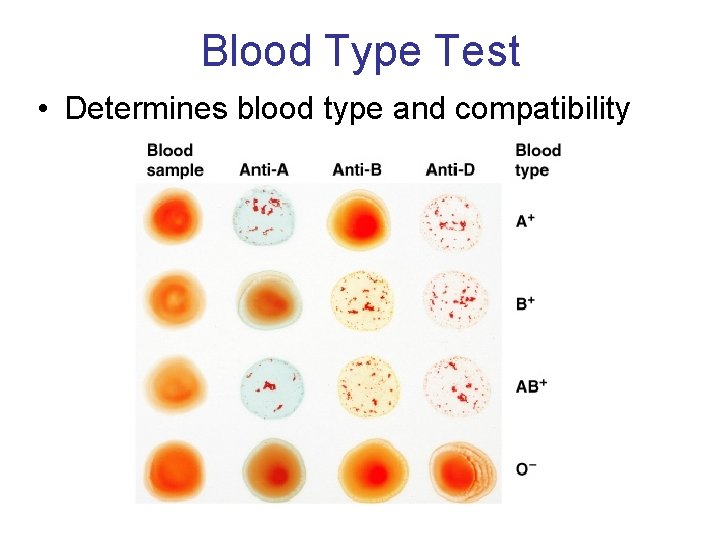 Blood Type Test • Determines blood type and compatibility Figure 19– 7 