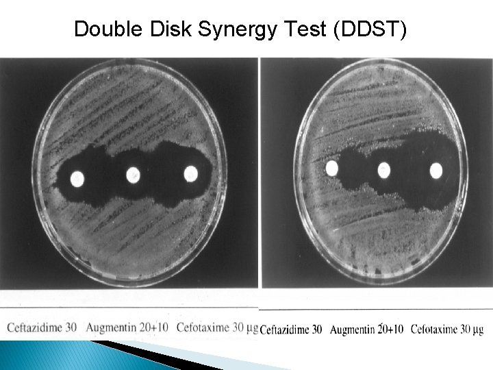Double Disk Synergy Test (DDST) 