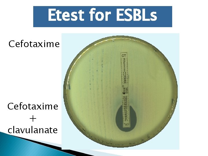 Etest for ESBLs Cefotaxime + clavulanate 