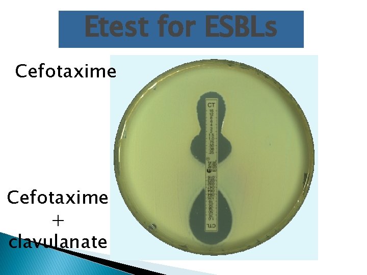 Etest for ESBLs Cefotaxime + clavulanate 
