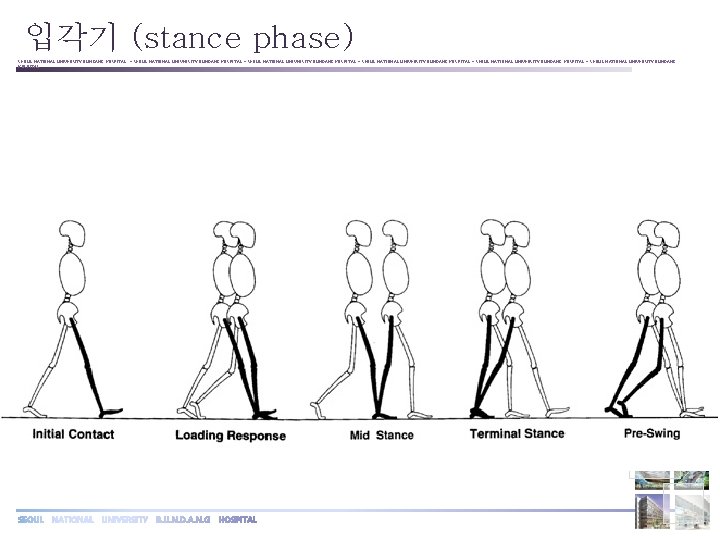 입각기 (stance phase) SEOUL NATIONAL UNIVERSITY BUNDANG HOSPITAL ◦ SEOUL NATIONAL UNIVERSITY BUNDANG HOSPITAL