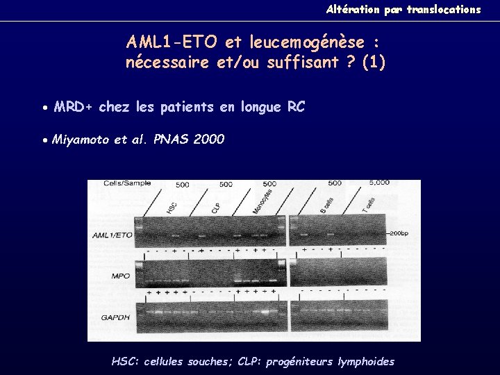 Altération par translocations AML 1 -ETO et leucemogénèse : nécessaire et/ou suffisant ? (1)