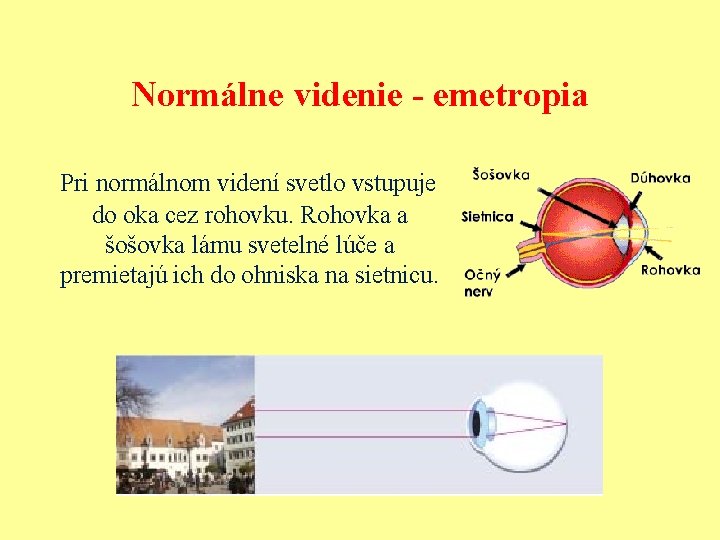 Normálne videnie - emetropia Pri normálnom videní svetlo vstupuje do oka cez rohovku. Rohovka