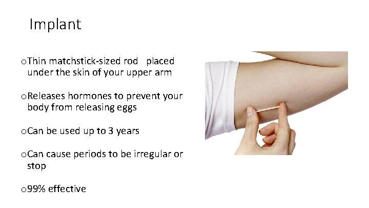 Implant o. Thin matchstick-sized rod placed under the skin of your upper arm o.