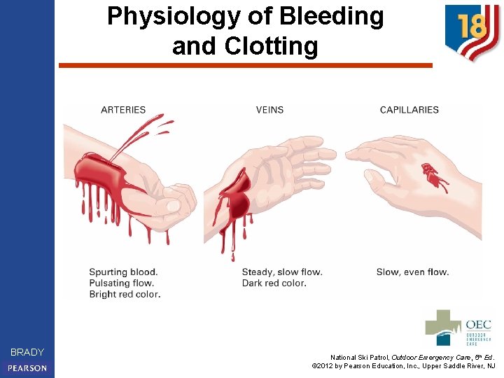 Physiology of Bleeding and Clotting BRADY National Ski Patrol, Outdoor Emergency Care, 5 th