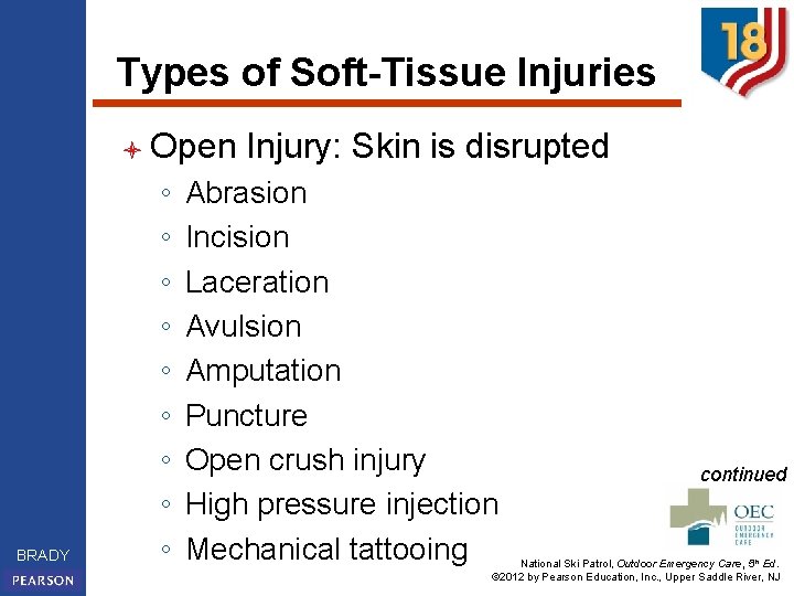 Types of Soft-Tissue Injuries l Open BRADY ◦ ◦ ◦ ◦ ◦ Injury: Skin