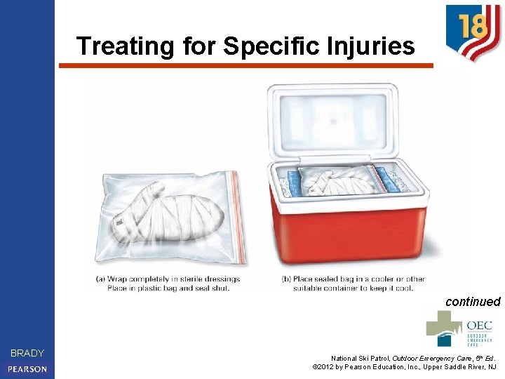 Treating for Specific Injuries continued BRADY National Ski Patrol, Outdoor Emergency Care, 5 th