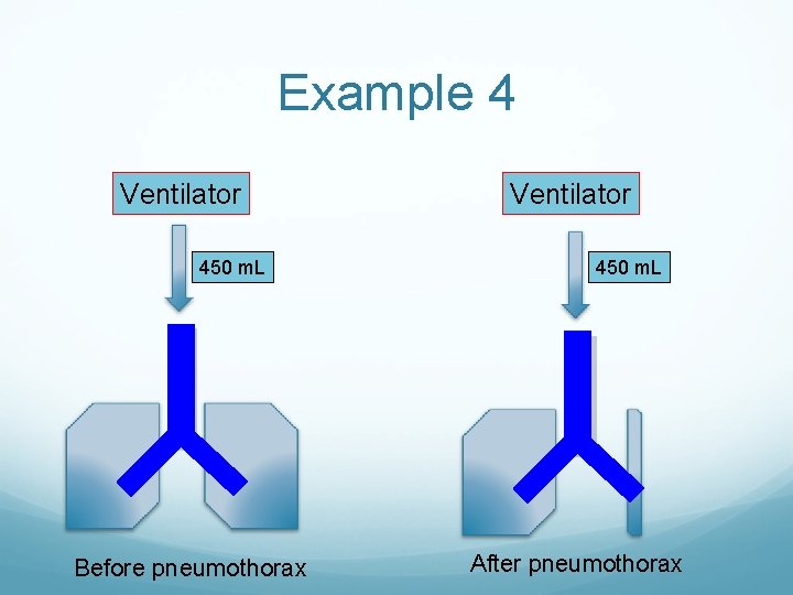 Example 4 Ventilator 450 m. L Before pneumothorax Ventilator 450 m. L After pneumothorax