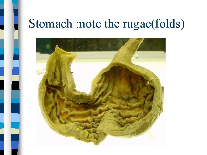 Stomach : note the rugae(folds) 