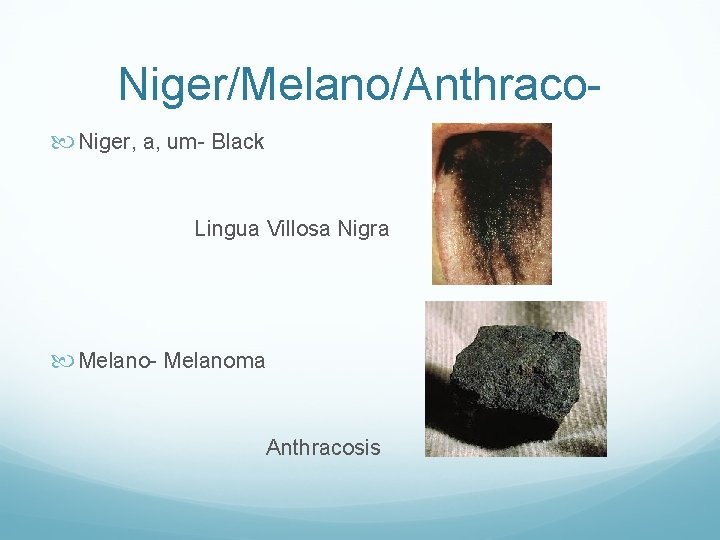 Niger/Melano/Anthraco Niger, a, um- Black Lingua Villosa Nigra Melano- Melanoma Anthracosis 