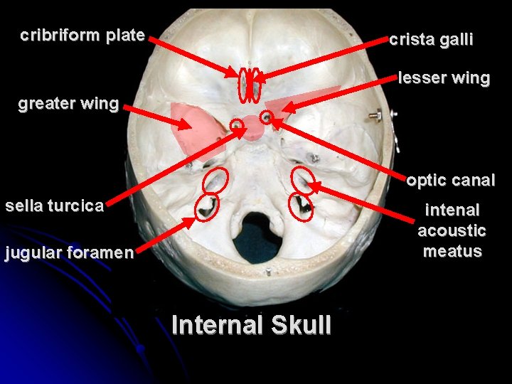 cribriform plate crista galli lesser wing greater wing optic canal sella turcica intenal acoustic