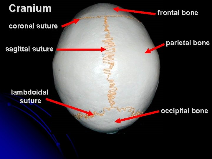 Cranium frontal bone coronal suture sagittal suture parietal bone lambdoidal suture occipital bone 