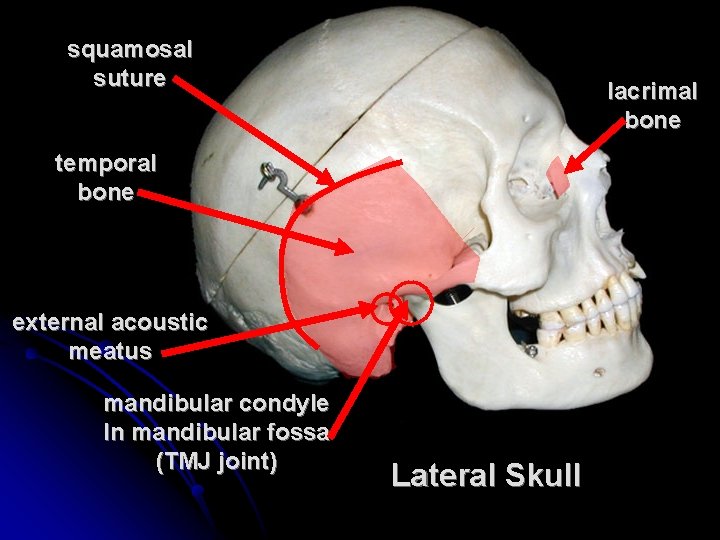 squamosal suture lacrimal bone temporal bone external acoustic meatus mandibular condyle In mandibular fossa