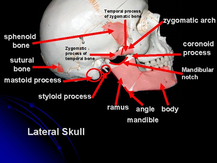 Temporal process of zygomatic bone sphenoid bone zygomatic arch coronoid process Zygomatic process of