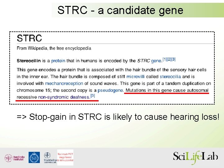 STRC - a candidate gene => Stop-gain in STRC is likely to cause hearing