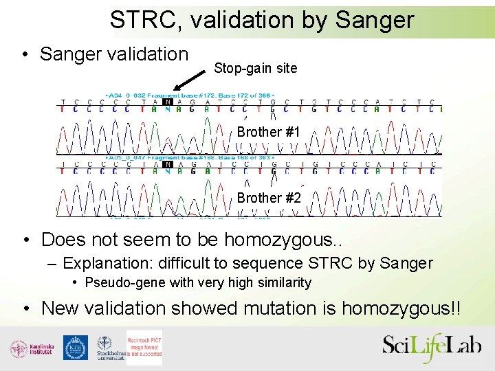 STRC, validation by Sanger • Sanger validation Stop-gain site Brother #1 Brother #2 •
