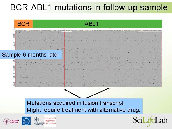 BCR-ABL 1 mutations in follow-up sample BCR ABL 1 Sample 6 months later Mutations