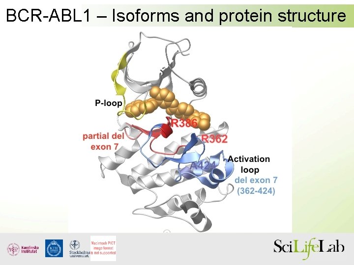 BCR-ABL 1 – Isoforms and protein structure 