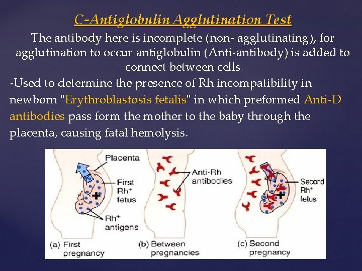 C-Antiglobulin Agglutination Test The antibody here is incomplete (non- agglutinating), for agglutination to occur
