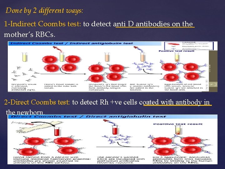 Done by 2 different ways: 1 -Indirect Coombs test: to detect anti D antibodies