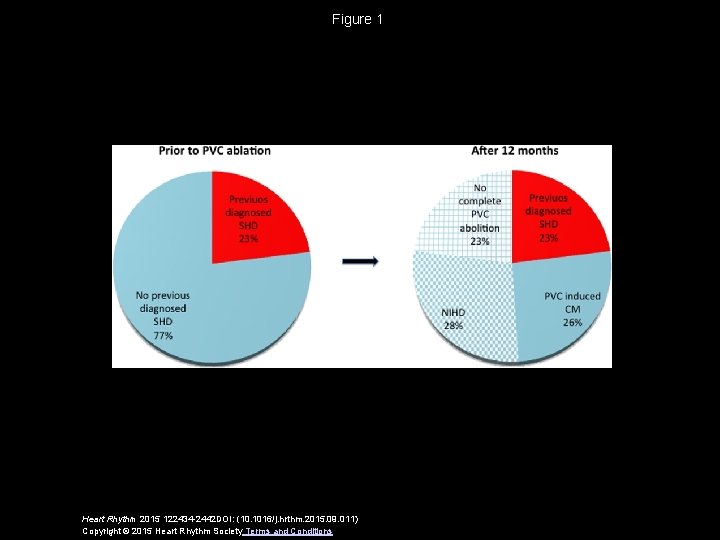 Figure 1 Heart Rhythm 2015 122434 -2442 DOI: (10. 1016/j. hrthm. 2015. 09. 011)
