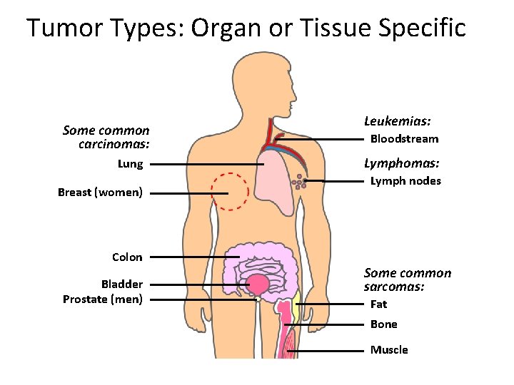 Tumor Types: Organ or Tissue Specific Some common carcinomas: Lung Breast (women) Colon Bladder